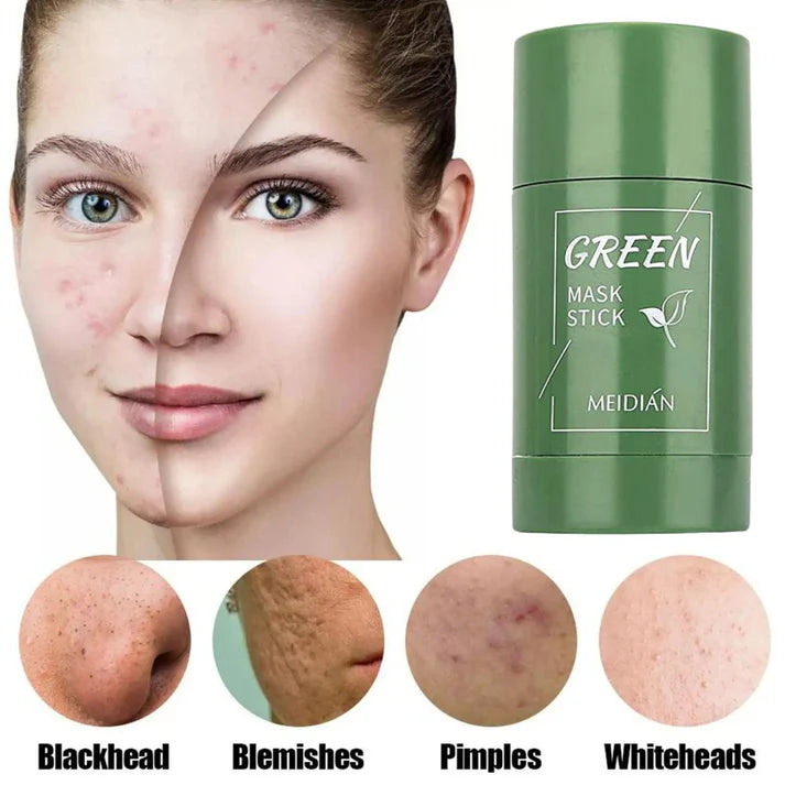 ORIGINAL Green Tea Mask Stick Facial Cleansing Oil Acne Deep Clean Pore My Store