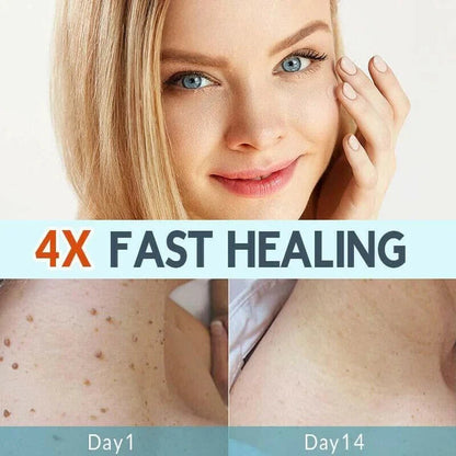 SKIN TAG REMOVER LIQUID MOLE WART ACNE PIMPLE PATCH REMOVAL SPOT SAFE & FAST My Store