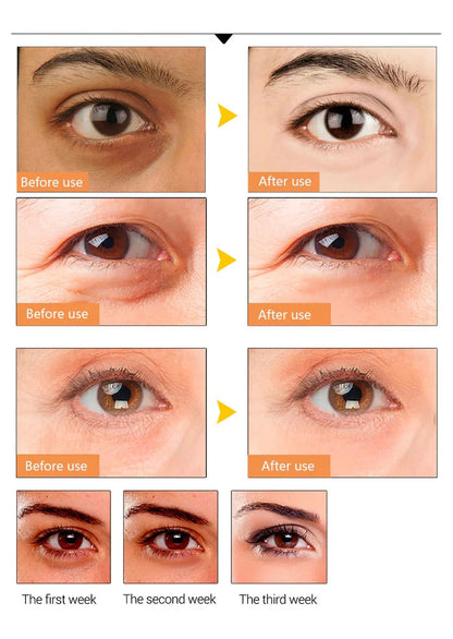 Pink Collagen Under Eye Patches Hyaluronic Acid Anti Ageing Vitamin C My Store
