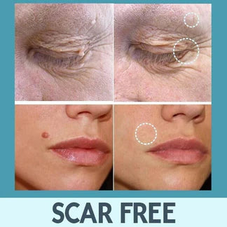 SKIN TAG REMOVER LIQUID MOLE WART ACNE PIMPLE PATCH REMOVAL SPOT SAFE & FAST Ausie Sales