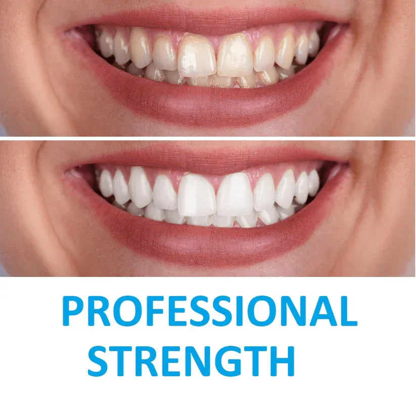 Before and after comparison of teeth with 'Professional Strength' text.

