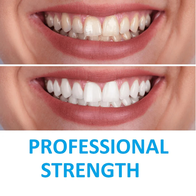 Dazzling White Instant Teeth Whitening Pen Cleaning Rotary Peroxide Bleaching - Ausie Sales