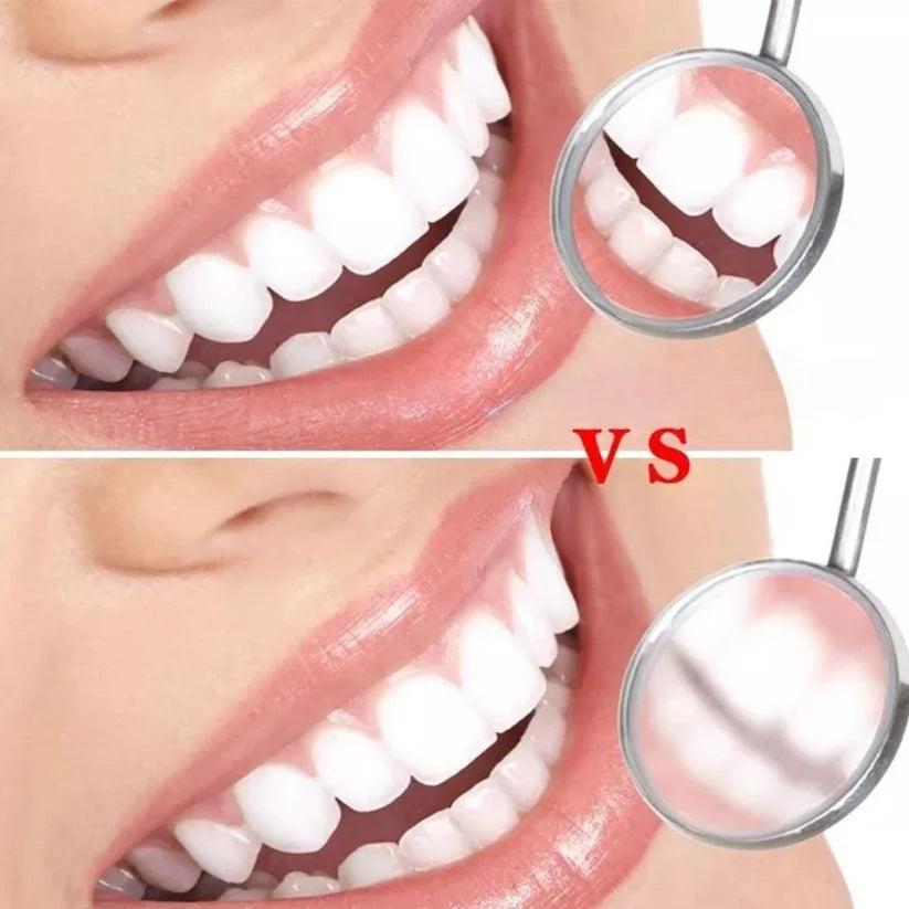 7PCS Dental Hygiene Cleaning Kits Tools Teeth Mirror Scraper Pick Scaler Tweezer Ausie Sales