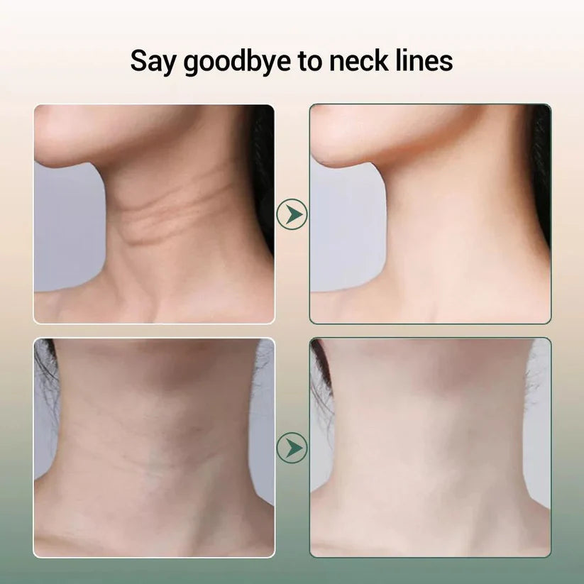 Face Neck Anti Wrinkle Machine Skin Tightening Lifting Device Facial Beauty Ausie Sales
