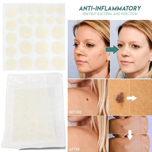 Skin Tag Remover Acne Pimple Patch Removal Facial Care Spot Plaster My Store
