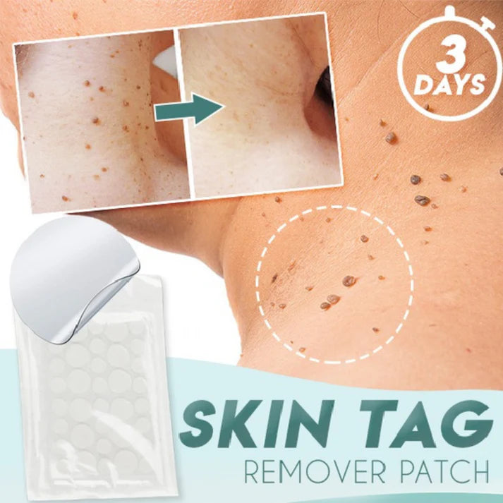 Skin Tag Remover Acne Pimple Patch Removal Facial Care Spot Plaster My Store
