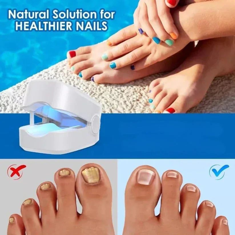 Advertisement for a natural solution for healthier nails with a nail lamp and before-and-after images.

