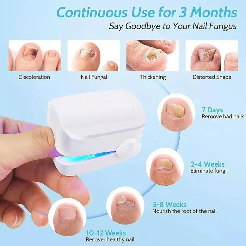 Product for treating nail fungus with step-by-step progress shown on nails.

