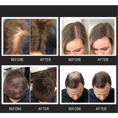 TOPPIK Hair Loss Building Fibers 27.5g Alopecia Keratin Thicker Concealer Fiber My Store